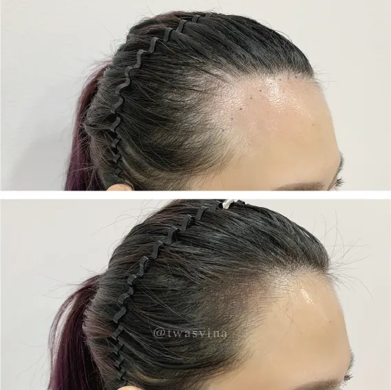 無框髮際線 作品